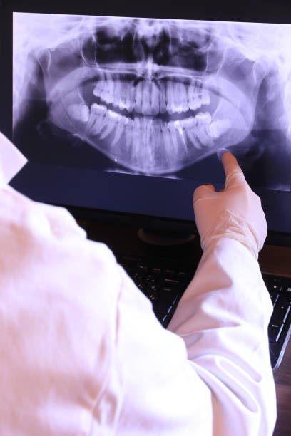 Best Emergency Broken Tooth Repair in Beverly Hills, MI