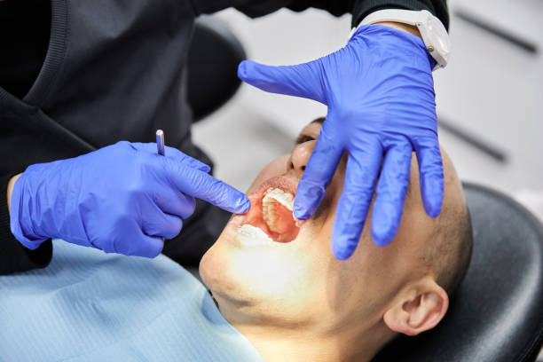 Best Emergency Tooth Extraction in Beverly Hills, MI