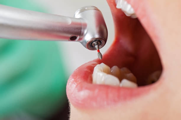 Best Emergency Treatment for Toothache in Beverly Hills, MI